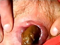 Man records himself shitting with his hairy ass