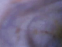 Beagle Colonoscopy GayBeast.com - Man Fucks Pet