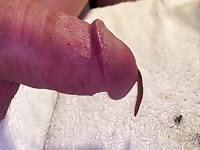 Worm crawls out 