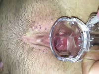 Open Pussi 