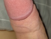 Longdick