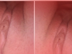 Titfix